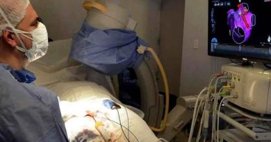 Realizan en el Hospital Posadas primera ablación en Argentina por radiofrecuencia cardíaca