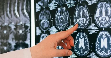 Un test busca detectar el Alzheimer 3,5 años antes del diagnóstico clínico